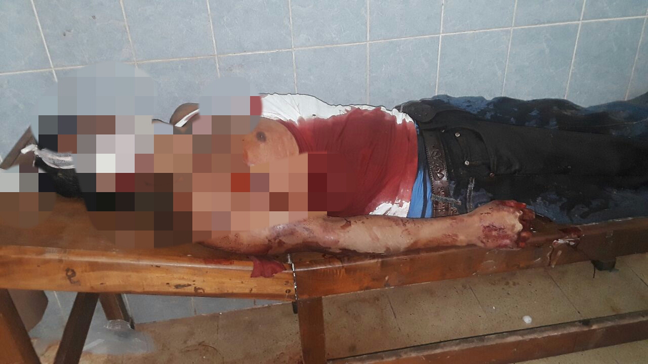 El cuerpo de Sergio Rafael Castro Obando de 27 años en la sala de emergencia del hospital Esteban Jean Serrano de Bonanza.,
