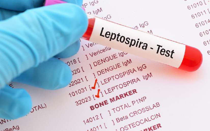 Leptospirosis a la baja y vigilancia activa ante enfermedades respiratorias y vectoriales